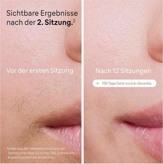 Braun IPL Silk Expert Pro 5 – IPL Geräte Haarentfernung, Dauerhafte und Schmerzfreie Haarentfernung für Zuhause – inkl. Etui, 2 Venus Rasierer, 2 Aufsätze, Designed In Germany – PL5157, Weiß/Gold