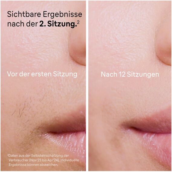 Braun IPL Silk Expert Pro 5 – IPL Geräte Haarentfernung, Dauerhafte und Schmerzfreie Haarentfernung für Zuhause – inkl. Etui, Venus Rasierer, 2 Aufsätze, Designed In Germany – PL5157, Weiß/Gold