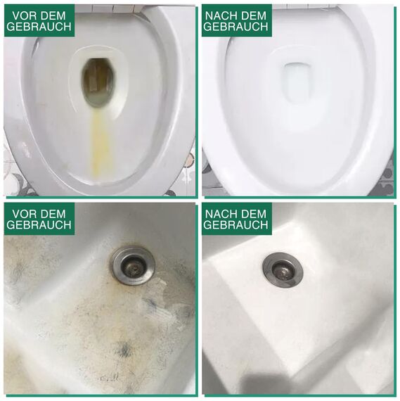 Bimsstein Toilettenreiniger, 6 Stück Bimsstein Toilette mit 1 Griff, Bimsstein für Toilette, Badezimmer, Küche, Pools, zur Entfernung von hartnäckigen Flecken